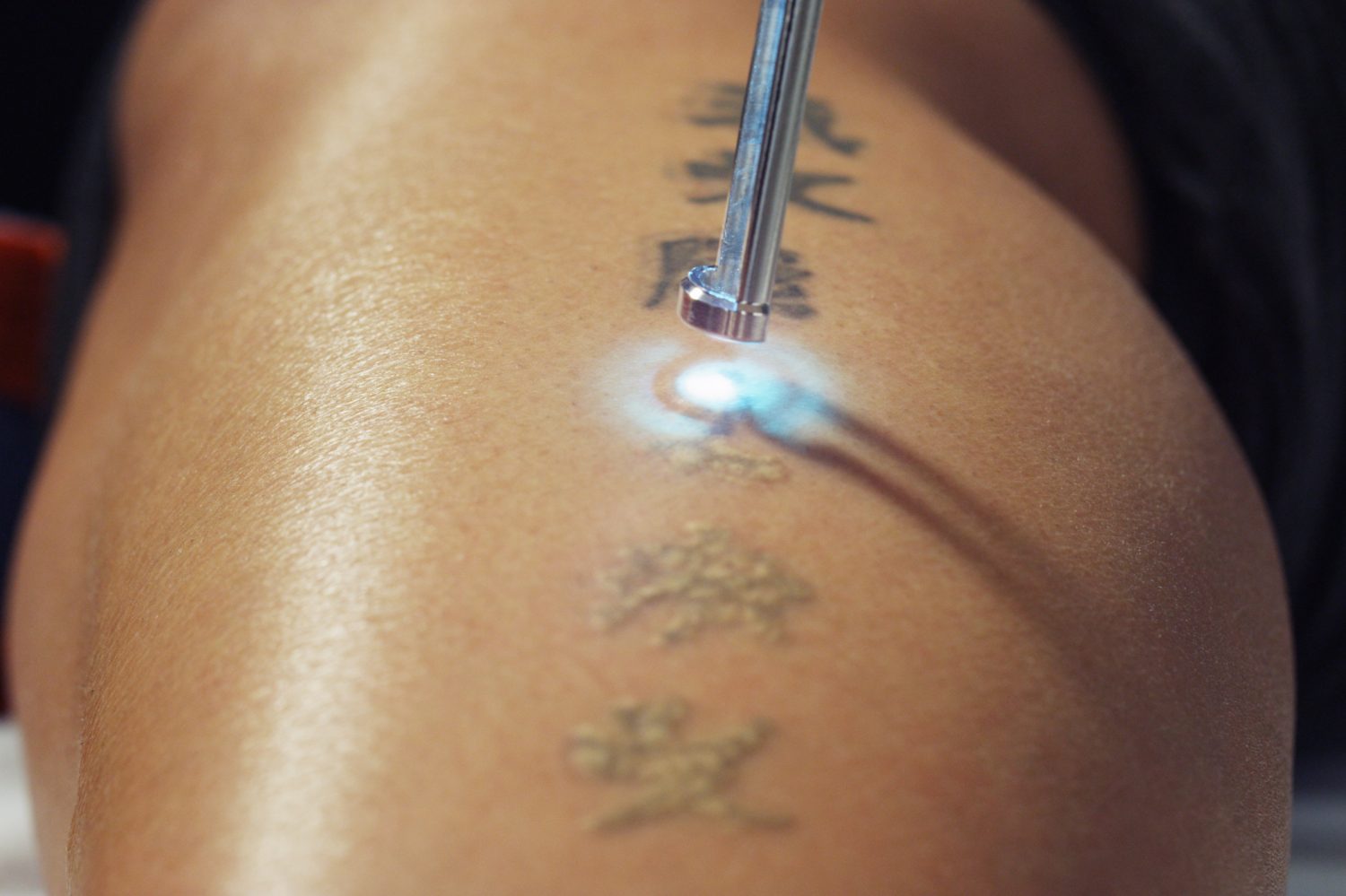 Tatoeages zijn een populair lichaamsversiering, maar de gevolgen van een tatoeage kunnen verstrekkender zijn dan je in eerste instantie verwacht. Tatoeages zijn namelijk in principe permanent en kunnen grote schade aanrichten aan de huid.